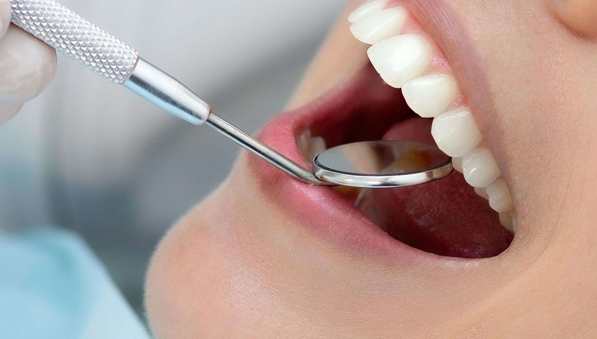 Comprehensive dental exam at Piedmont Dental By Design
